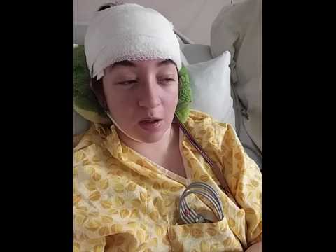 72 hour eeg 72 hour eeg