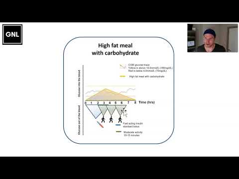 04 Mealtime Insulin Guide: High fat meals with carbs (www.theglucoseneverlies.com)