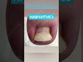Подологічна практика @KABINET.PODOLOGA в м.Дніпро ⚪️ ОГЛАЙН-курси для майстрів педикюру і подологів