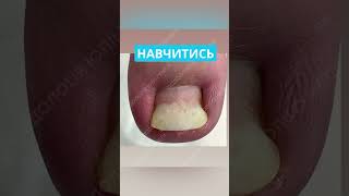 Подологічна практика @KABINET.PODOLOGA в м.Дніпро ⚪️ ОГЛАЙН-курси для майстрів педикюру і подологів