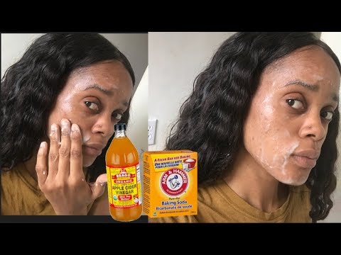 How I got rid of bumps and acne scars