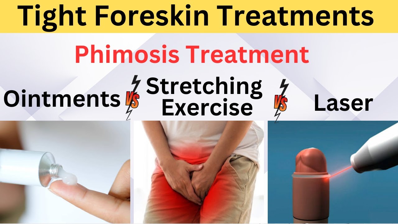 Tight Foreskin Treatments, Phimosis Treatment