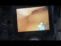 Viewpro dh60시리즈 내시경카메라