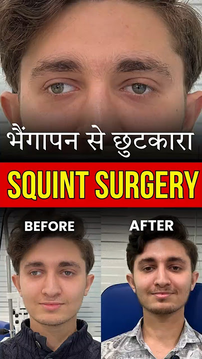 Squint Surgery Success Story | Patient Shares Experience at EyeMantra Hospital