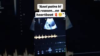 From a tiny heartbeat… to my biggest happiness 🥹🤍”#motherhood #love #emotional #motherlove #viral