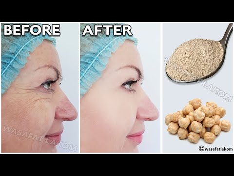 Video: The Latest To Remove Wrinkles