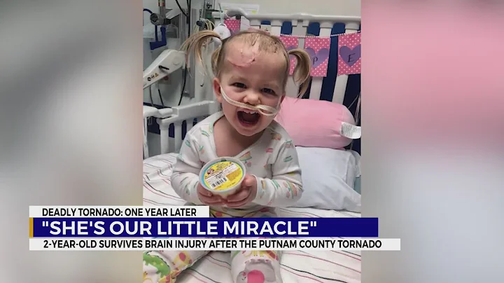 2-year-old survives brain injury after Putnam County tornado