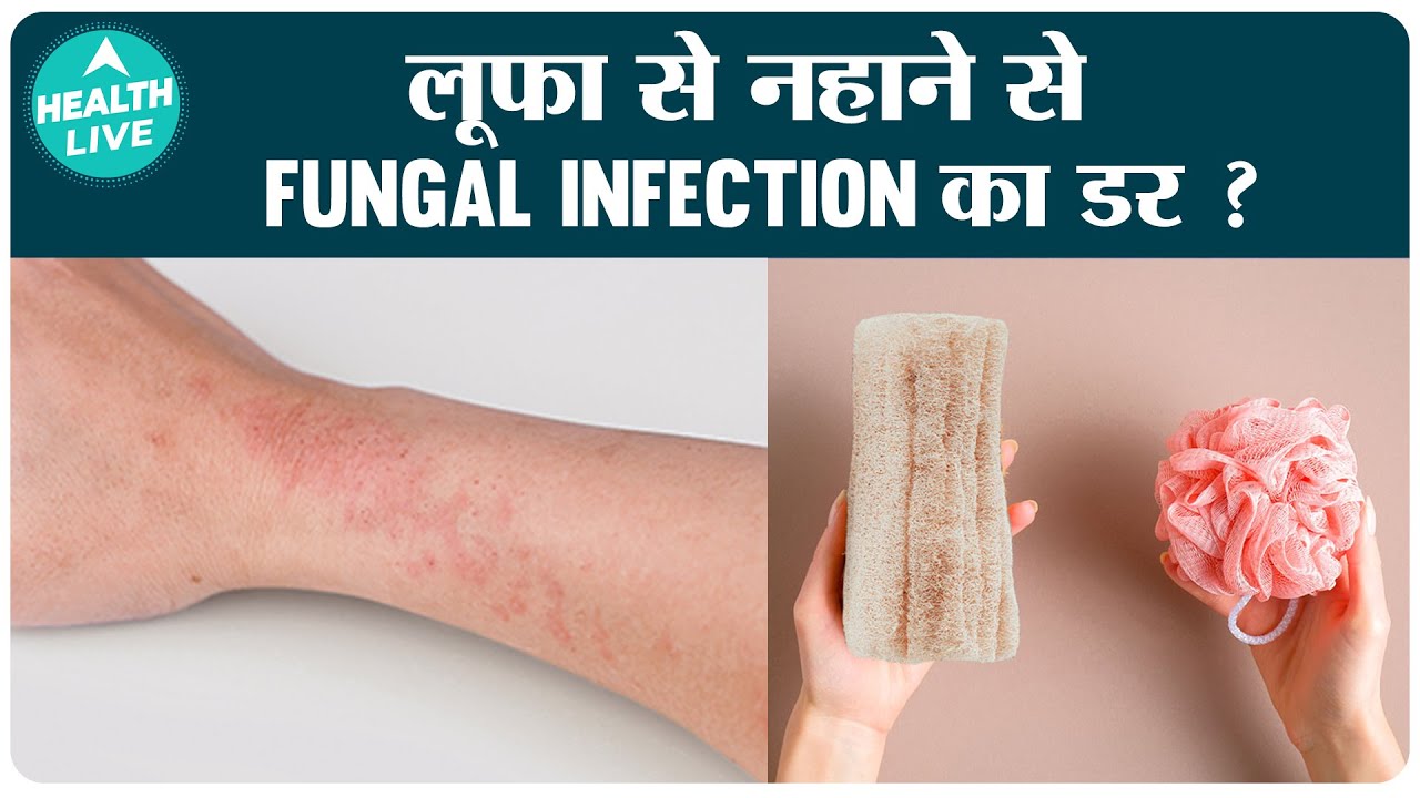 Luffas Can Cause Fungal Infection to Your Body How to Disinfect your