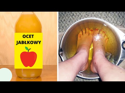 Moczą stopy w occie jabłkowym raz w tygodniu - Efekty Cię zaskoczą!