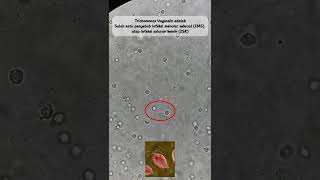 Penyebab Infeksi Menular Seksual (IMS) dan Infeksi Saluran Kencing (ISK) #microscope #laboratory Penyebab Infeksi Menular Seksual (IMS) dan Infeksi Saluran Kencing (ISK) #microscope #laboratory