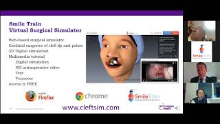 Webinar - Leveraging Simulation Technology: Smile Train’s Virtual Surgery Simulator Mobile App screenshot 4