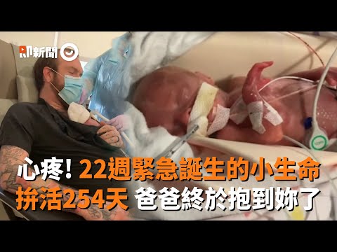 心疼! 22週緊急誕生的小生命  拚活254天 爸爸終於抱到妳了｜暖聞｜寶寶｜早產兒