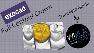 Exocad - Full Contour Crown (Design)