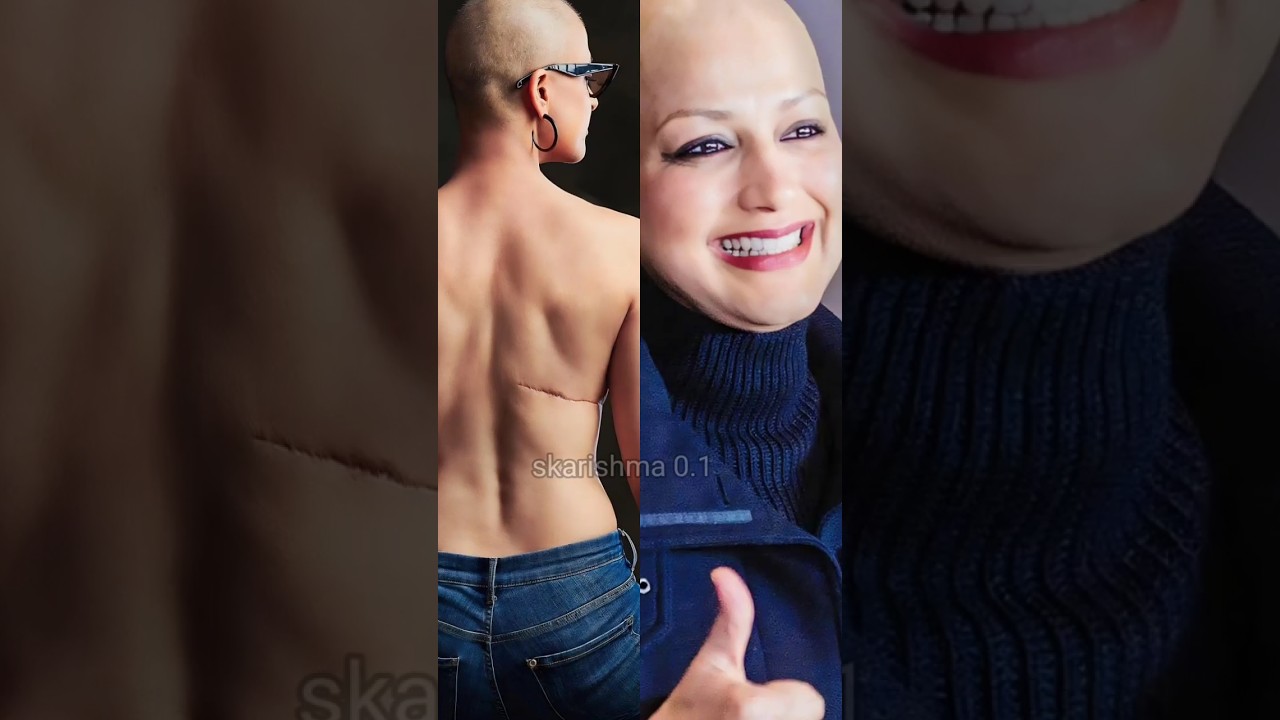 सीने पर 24 इंच का निशान और गंजापन करता था परेशान , यू थीं ऐक्ट्रेस की हालत 😮😱 #viral #shorts