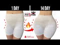 Do This For Get Rid Of 🔥 Hip Dips (AT HOME)