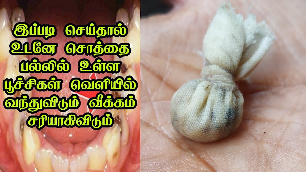 நகம் உள்நோக்கி வளர்தல் பிரச்சனையை எப்படி சரி செய்வது? - Quora