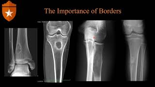 Basics of Bone Imaging screenshot 4