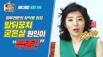 [메디텔] 발뒤꿈치 굳은살의 원인이 이것?(굳은살, 발냄새 있으신 분들은 주목!)