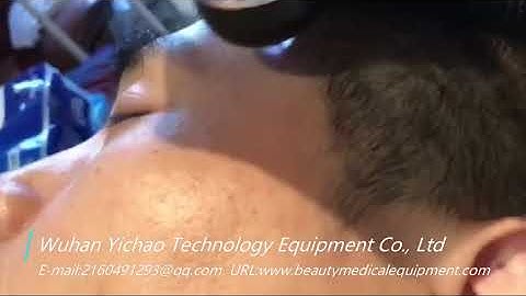 Low temperature plasma cosmetic machine