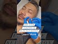 Dark Undereyes?? #aesthetics #aesthetictraining #antiaging #botoxtraining #nursetraining