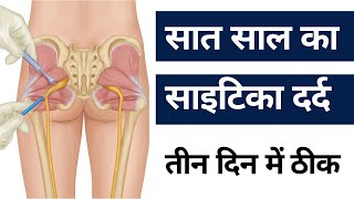 7️⃣ साल का कमरदर्द ,साइटिका दर्द , तीन दिन में ठीक। yoga for back pain &amp; sciatica 