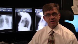 Three Things to Know About Lung Cancer Screening