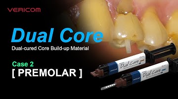 Dual Cured Core Build up Material Premolar -2