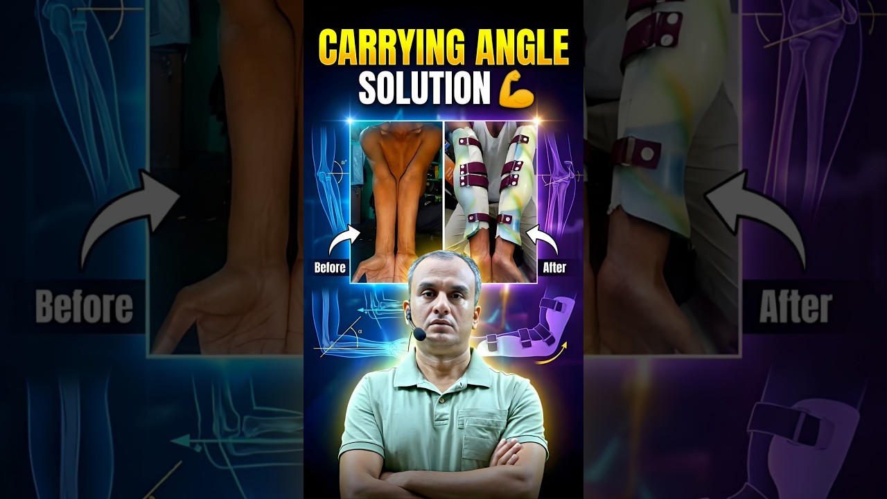 Carrying Angle solution 
