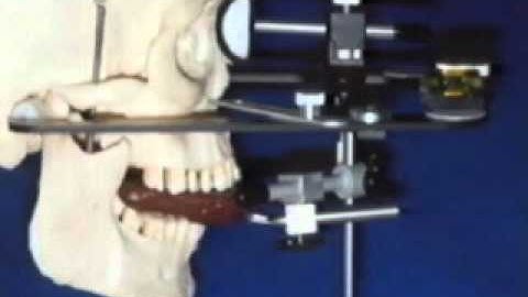 Kois System- Introduction by Panadent