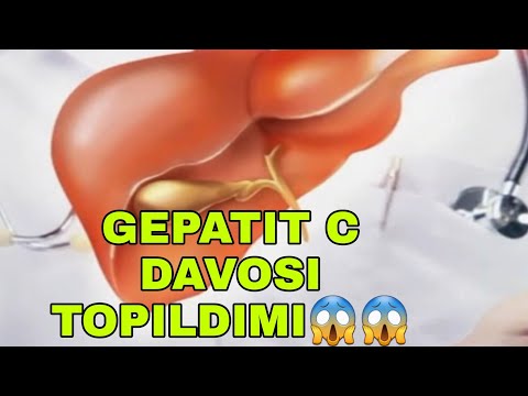 GEPATIT C NING DAVOSI TOPILDIMI ГЕПАТИТ С НИНГ ДАВОСИ ТОПИЛДИМИ