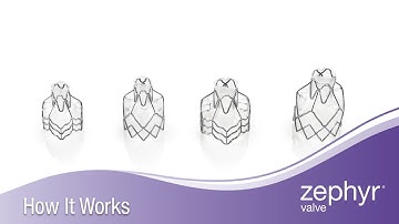 How It Works: What is The Zephyr Valve and if It