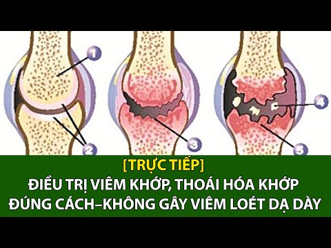 Video: 3 cách điều trị viêm khớp thoái hóa