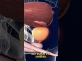Prostate Anatomy Explained in 3D – Location, Size & Function