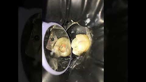 This is how we make seal with Gutta Percha