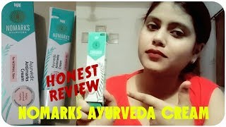 *New* Bajaj Nomarks Ayurvedic Antimarks Cream Review | Honest Review | By Tips And Tricks in Hindi