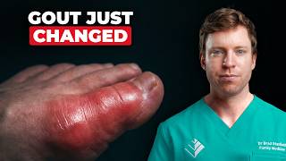 I’m Tired of Gout Not Being Treated Properly