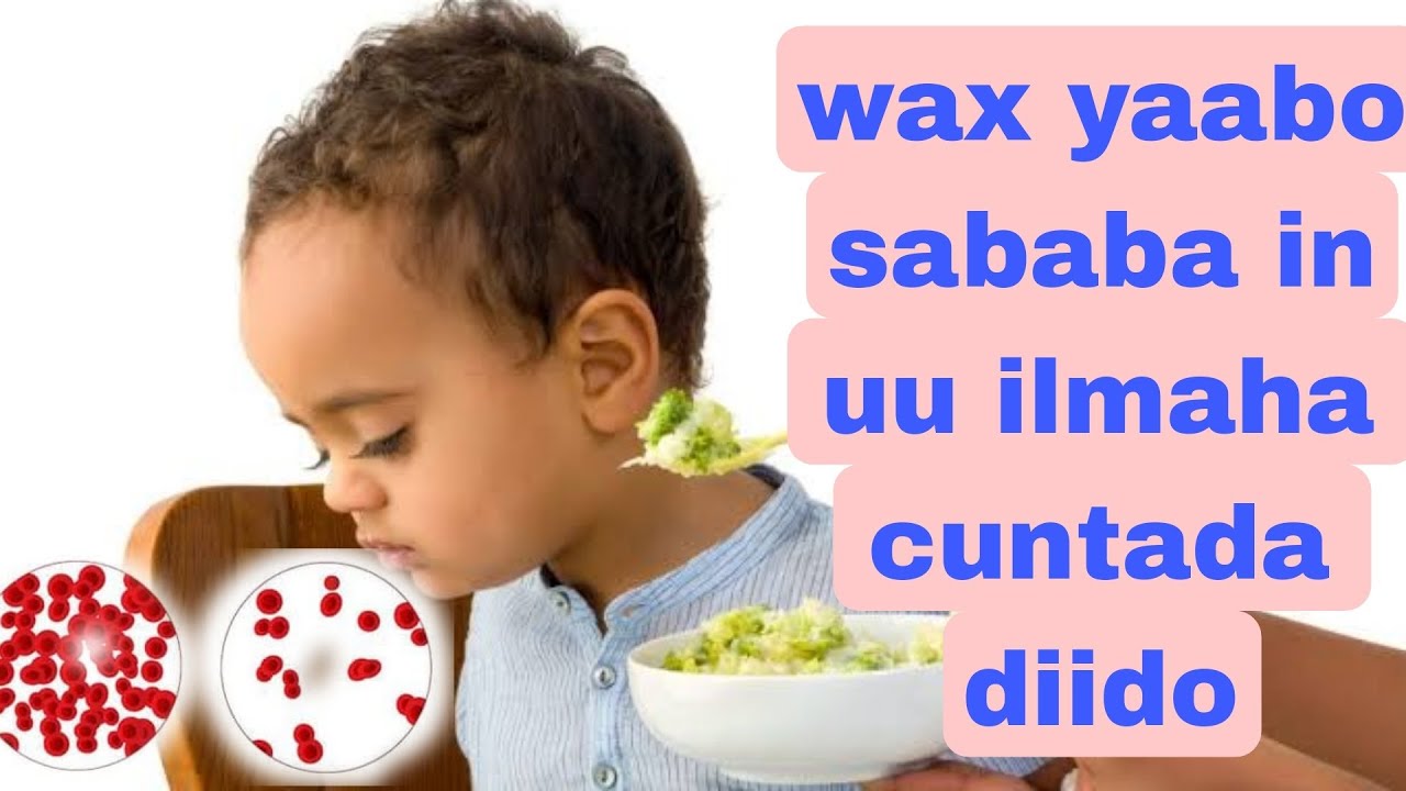 CUNTO XUMADA CARUURTA|| IYO  VITAMINADA OO JIRKA ILMAHA KU YARAADA