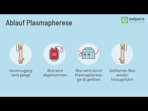 Video: Wo wird die Plasmapherese durchgeführt?