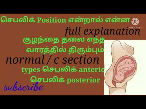 Cephalic position செபாலிக் முழு விளக்கம்/ head down position/cephalic presentation andtypes in tamil