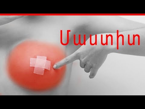 Video: Ինչու՞ օտիսն ունի կուրծք: