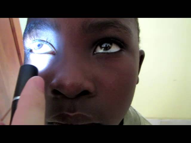 Приобретённая односторонняя корковая слепота? Blindness without pupillary defect?