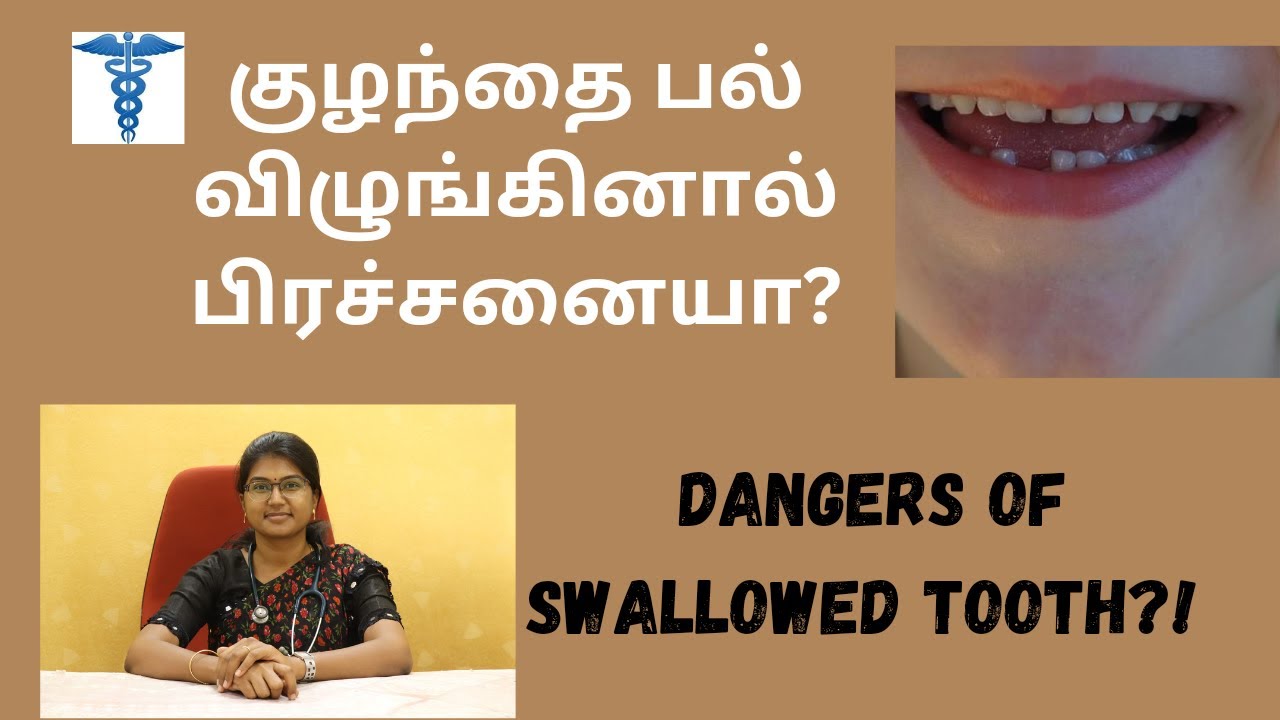 😬👶பால் பல் விழுங்கினா பயமா?|swallowed tooth dangers in Tamil | ohmydoctor🌟|home remedy|baby doctor