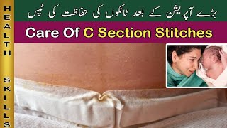 Take Care Of C Section Stitches/C Section Ke Tanke Kese Thik Kare/After C Section Recovery.