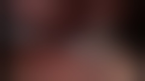 Flex® Robotic System - Endoscopic Submucosal Dissection (ESD)