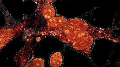 Neural adhesions