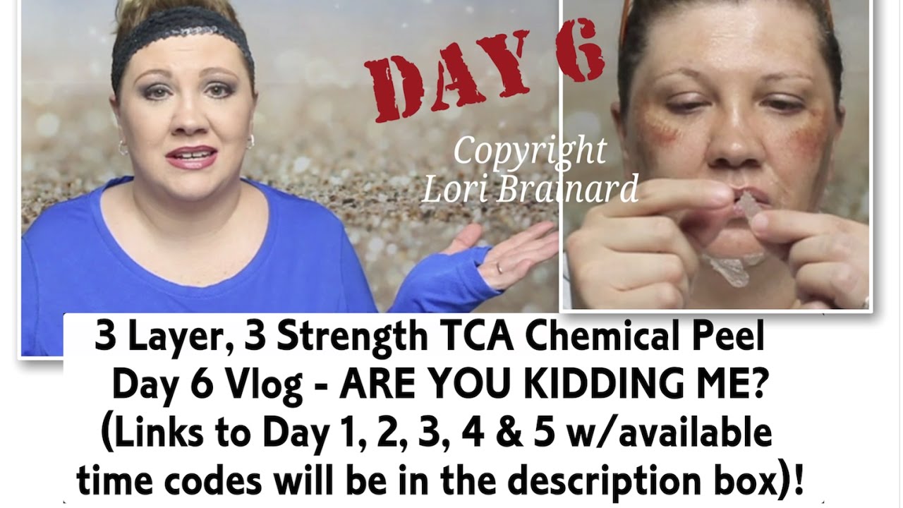 20 tca home chemical peel instructions with pictures. 20 tca home chemical peel instructions with pictures.