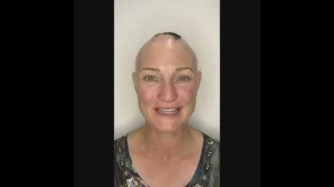 HRH Beauty Eyebrow Tattoo Transformation on Alopecia Client