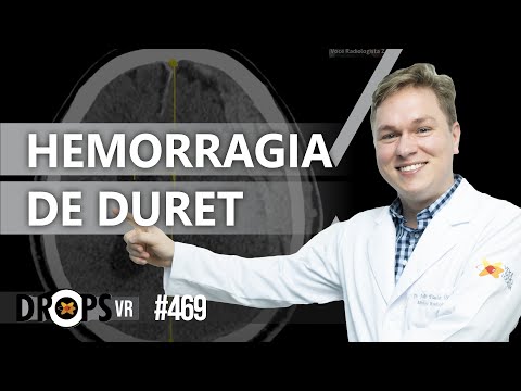 Vídeo: O que é hemorragia de duret?