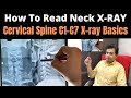 How to read Neck x ray, How to read x ray of Cervical spine, Cervical Spine x ray Reading C1-C7