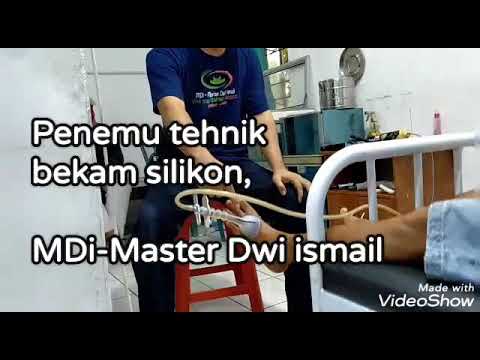 Tempat bekam yang canggih, penemu teknik bekam silikon, Master Dwi Ismail ahli pakar terapi di Jember Jawa timur